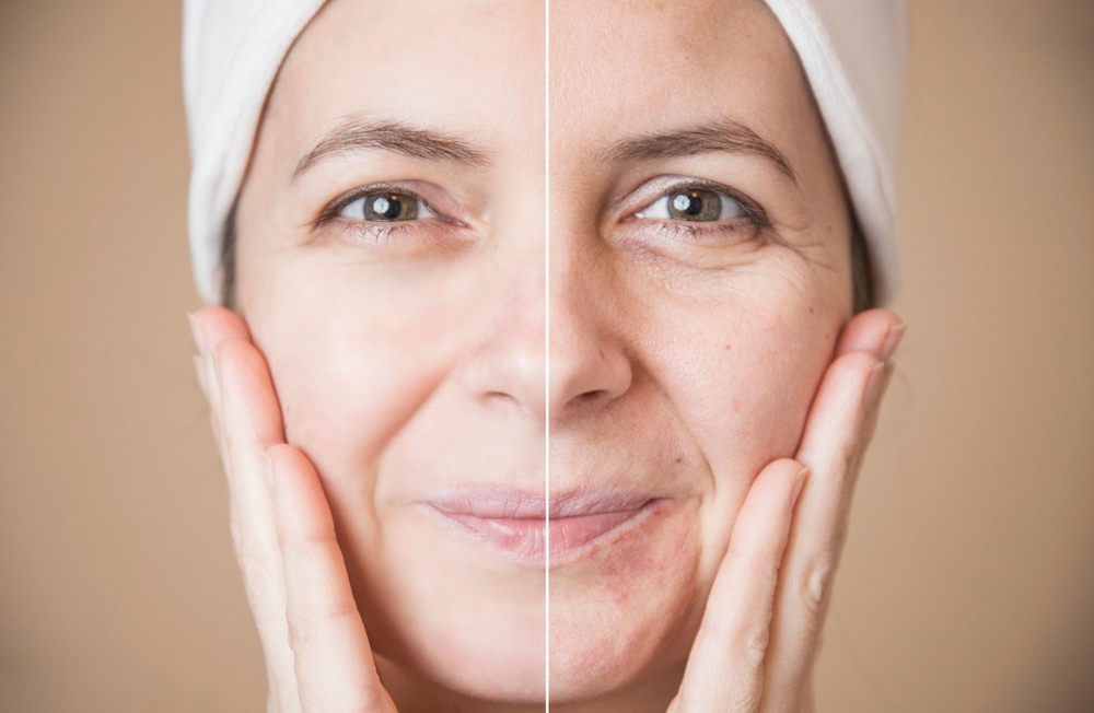 Eficienta cremelor cu retinol in combaterea ridurilor