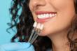 Beneficiile fatetelor dentare pentru un zambet stralucitor si sanatos