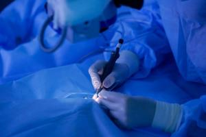 Chirurgia refractiva si solutiile moderne pentru corectarea miopiei