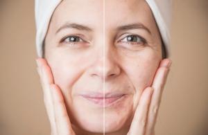 Eficienta cremelor cu retinol in combaterea ridurilor